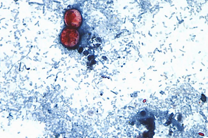 Esta fotografía tomada a través de un microscopio y difundida por los CDC muestra Cyclospora cayetanensis oocysts de una muestra de heces. (CDC vía AP, Archivo)