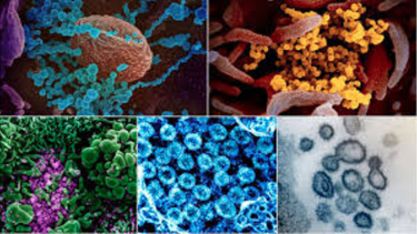 a que temperatura y nivel los rayos solares y la humedad son mortales para el coronavirus en superficies y en aire