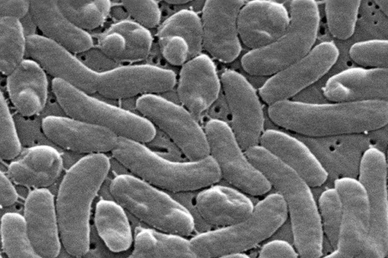 ARCHIVO - Esta imagen del microscopio electrónico de 2005 proporcionada por los Centros para el Control y la Prevención de Enfermedades de EEUU (CDC) muestra bacterias Vibrio vulnificus. (Foto, Janice Haney Carr/CDC vía AP, Archivo)