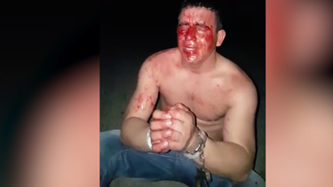 cubano denuncia golpiza policial estando esposado