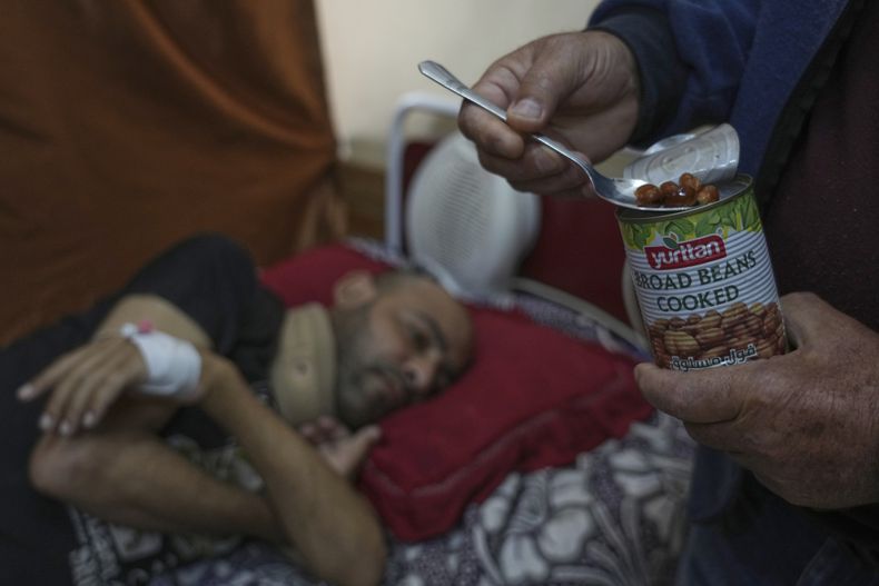 Sobhi al-Bursh, quien resultó herido en un bombardeo y perdió el pie, es alimentado con frijoles que su padre, Mohamed, llevó al Hospital Nasser, el martes 6 de mayo de 2025, en Jan Yunis, Franja de Gaza. (AP Foto/Abdel Kareem Hana)
