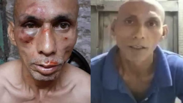 opositor cubano recibe golpiza en la prision de kilo 9 y se encuentra en mal estado de salud