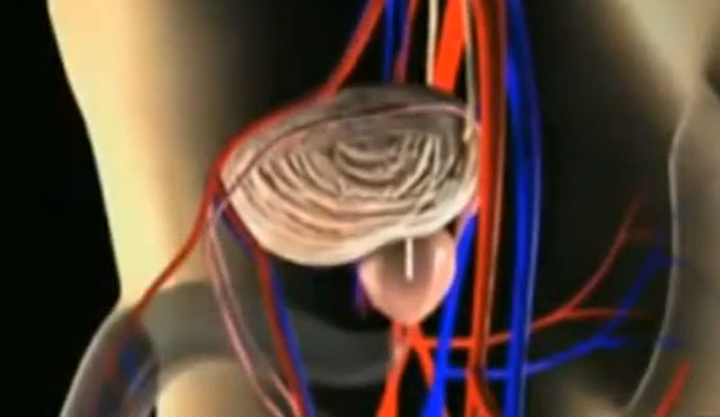 Un nuevo estudio que relaciona el sexo con el cáncer de próstata.