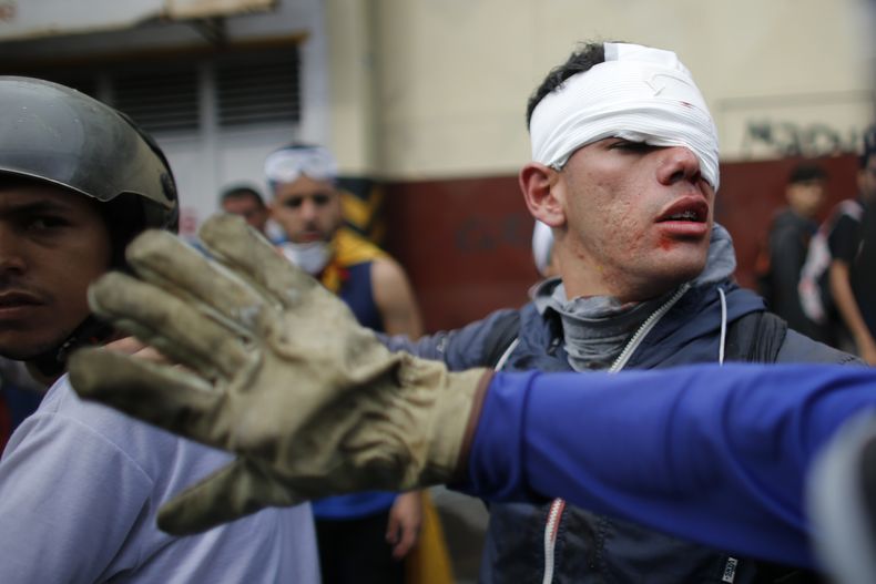 AMS-GEN_AP_EXPLICA-VENEZUELA_CRISIS_POLITICA-3.jpg