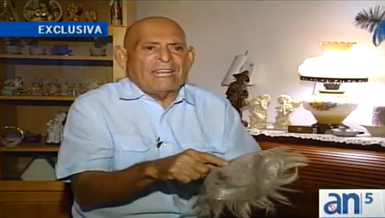 Un jubilado de 82 años ha presentado una queja en el condado Miami Dade alegando que fue estafado por una clínica para la reconstrucción de cabello.