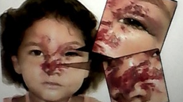 Policía castrista apedrea a una niña