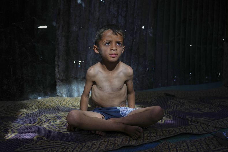 Ahmed El-Sheikh Eid, un niño de 7 años que presenta señales de desnutrición, posa para una foto en la tienda de campaña de su familia en un campamento para palestinos refugiados Mawasi, en Jan Yunis, en la Franja de Gaza, el viernes 2 de mayo de 2025. (AP Foto/Abdel Kareem Hana)