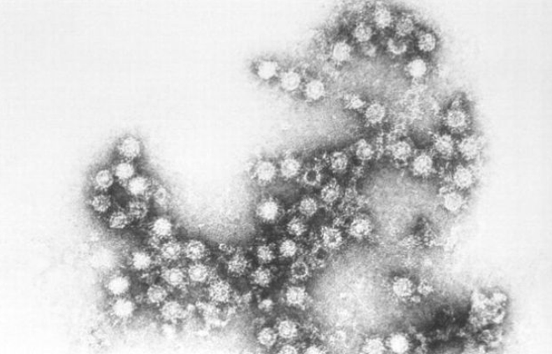 Los centros para el control y prevención de enfermedades anunciaron que el virus respiratorio que ha llevado a miles de niños al hospital en los Estados Unidos desde mediados de agosto se ha detectado en 4 personas que murieron.