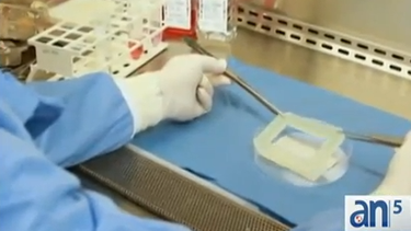 americateve | Los avances de la ciencia superan por momentos a la imaginación mas delirante. Oigan esto:  cirujanos han logrado reconstruir órganos completos,  para ser posteriormente trasplantados.