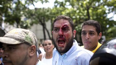 Venezuela inhabilita políticamente al opositor Capriles