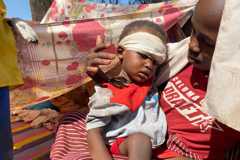 Un niño sudanés que huyó de la ciudad de el-Fasher con su familia después de que las fuerzas paramilitares de Sudán asesinaran a cientos de personas en la región occidental de Darfur, recibe tratamiento en un campamento de Tawila, Sudán, el domingo 2 de noviembre de 2025. (AP Foto/Mohammed Abaker)