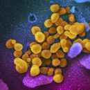 Esta imagen de microscopio electrónico distribuida por los Institutos Nacionales de Salud de EEUU en febrero de 2020 muestra el coronavirus SARS-CoV-2, indicado en amarillo, emergiendo de la superficie de las células (azul/rosa). (NIAID-RML vía AP, Archivo)