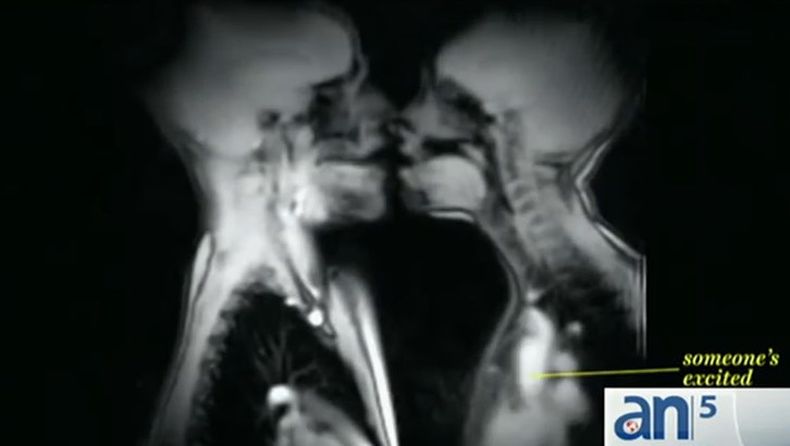 La ciencia no deja de sorprendernos y en esta ocasión han desnudado el placer que provoca el sexo a través de imágenes tomadas por resonancia magnética.