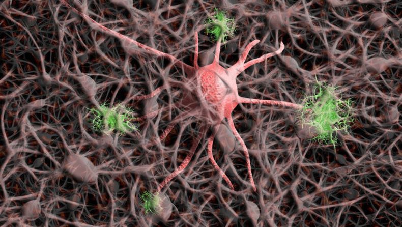 Imagen ilustrativa del cáncer cerebral. | Pixabay / geralt