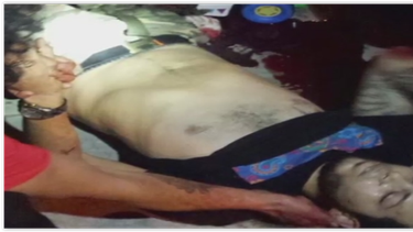 americateve | joven herido.PNG