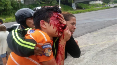 imagenes sensibles: represion chavista deja ciego a un adolescente de 16 anos