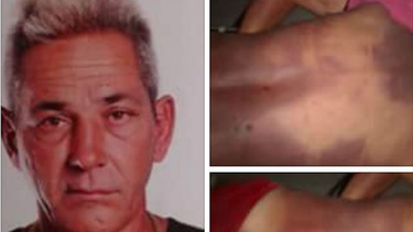 hombre muere en unidad policial de placetas tras recibir una golpiza