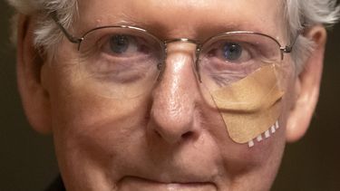 El líder de los republicanos en el Senado, Mitch McConnell, con una venda en la cara mientras camina hacia una votación en el Senado, el 10 de diciembre del 2024, en Washington. (AP foto/Mark Schiefelbein)