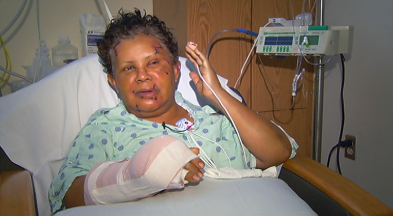 mujer atacada a machetazos.png