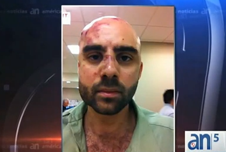 Un profesor de Miami- Dade College fue golpeado brutalmente a plena luz del día en el estacionamiento sur del campus de Kendall.