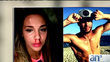 ex bailarin de ricky martin acusado de golpear a su novia se presenta  en corte
