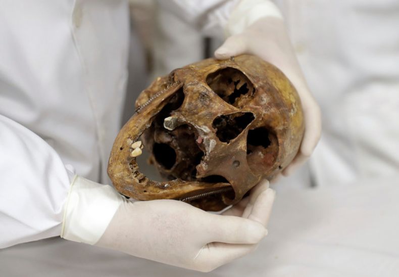 ARCHIVO - En esta fotografía del sábado 7 de diciembre de 2016, el médico forense Daniel Muñoz muestra el cráneo del criminal de guerra nazi Josef Mengele, en la Facultad de Medicina de la Universidad de São Paulo, en São Paulo, Brasil. (Foto AP/Andre Penner, archivo)