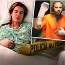 Cubana de Miami sobrevive a 34 puñaladas de su expareja: Pensé que iba a morir