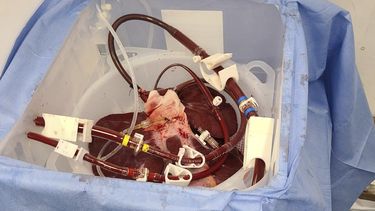 Foto entregada por eGenesis el 18 de enero del 2024 que muestra un hígado de cerdo genéticamente modificado en Massachusetts, antes de ser llevado a la Universidad de Pensilvania en Filadelfia en diciembre del 2023. (eGenesis via AP)