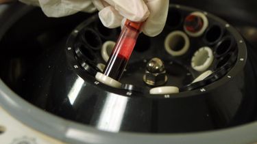 laboratorios exigen accion por atrasos y cambios en pagos