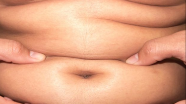 ¿es posible perder 2 centimetros de grasa abdominal en cuatro semanas?