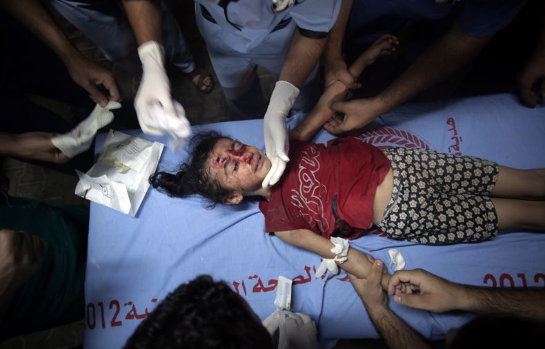 M&eacute;dicos palestinos tratan a una ni&ntilde;ita en el hospital kuwait&iacute; del campamento de refugiados Rafa en el sur de Gaza el 4 de agosto del 2014 (AP Foto/Khalil Hamra)