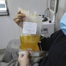 Estudian usar sangre de pacientes recuperados de coronavirus