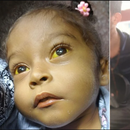 Niña cubana que necesitada de un trasplante de hígado obtiene visa humanitaria para Estados Unidos