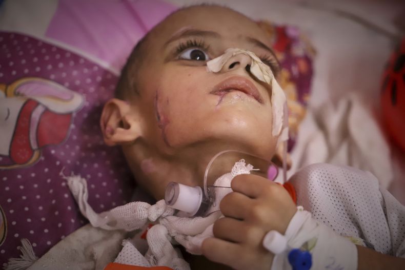 Amr al-Hams, de tres años y con lesiones cerebrales causadas por un ataque israelí en la carpa de su familia en abril, se ve en una cama en el Hospital Nasser en Jan Yunis, Franja de Gaza, el miércoles 25 de junio de 2025. (AP Foto/Mariam Dagga)