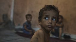 Yazan Abu Ful, un niño de 2 años que padece desnutrición, mira a su alrededor el miércoles 23 de julio de 2025 en el campamento de refugiados Shati, en Ciudad de Gaza. (AP Foto/Jehad Alshrafi)