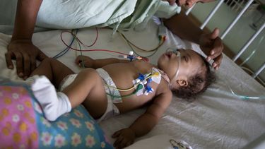 americateve | Eduardo Ribera, de 1 a&ntilde;o, es confortado por su madre  Oasis Pelaez mientras se recupera despu&eacute;s de una operaci&oacute;n del coraz&oacute;n en el hospital infantil cubano William Soler. La Habana, lunes 07 de octubre de 2013. El embargo estad