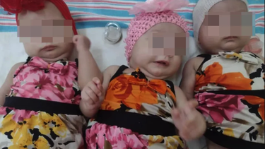 bebe trilliza cubana fallece en hospital de camagüey por presunta negligencia medica