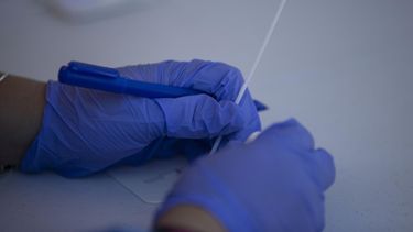 laboratorios clinicos piden prudencia en la utilizacion de pruebas de covid-19