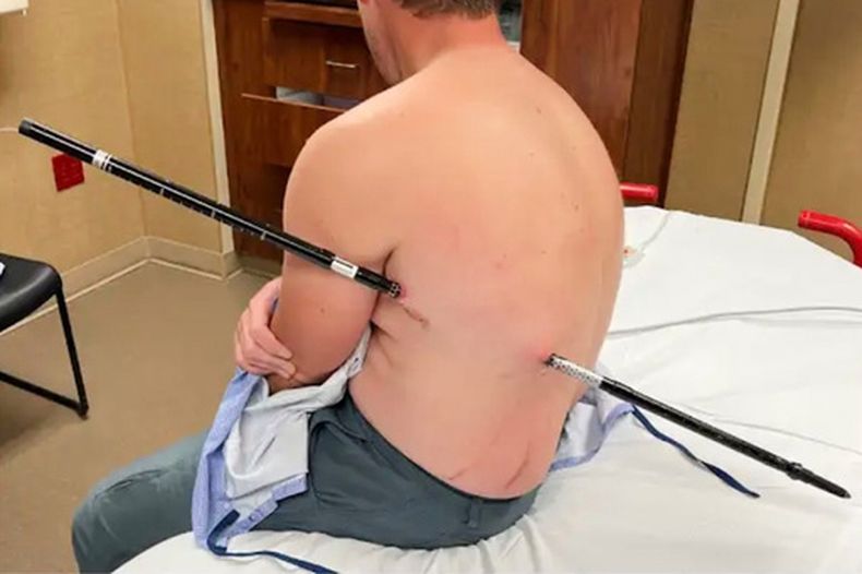 En esta imagen, proporcionada por David Cifaldi, se puede ver a Cifaldi mientras era atendido el 20 de julio de 2026 en el hospital regional St. Vincent en Billings, Montana. (Jessee Ross via AP)