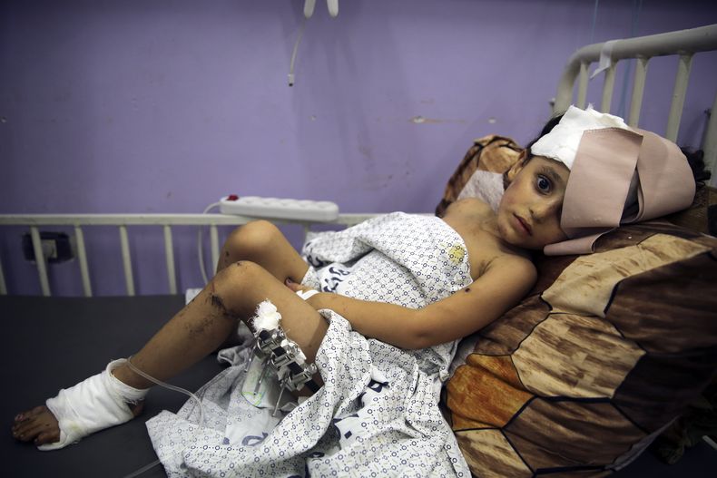 Kenzi al Madhoun, un niño de cuatro años que resultó herido en un bombardeo israelí, en el hospital Al Aqsa, en Deir al Balah, en la Franja de Gaza, el 1 de noviembre de 2023. (AP Foto/Abdel Kareem Hana)