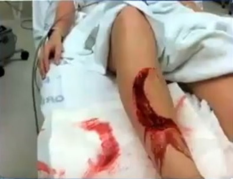 El más reciente caso de ataque de tiburón vuelve a llamar la atención sobre la Florida, una zona donde se producen con mucha frecuencia estos incidentes.