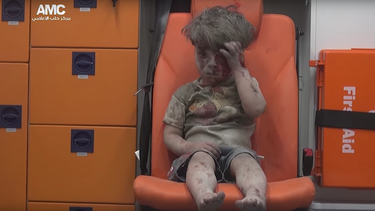 la desgarradora imagen de un nino herido por un bombardeo en alepo, siria