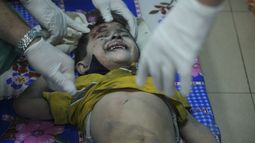 Un niño palestino herido tras un bombardeo israelí es atendido en el hospital en Deir al-Balah, al sur de la Franja de Gaza, el 17 de octubre de 2023. (AP Foto/Hatem Moussa)