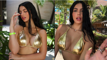 rachel arderi comparte el antes y despues de su cirugia estetica en miami y genera revuelo en redes