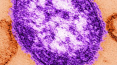 americateve | AMN-MED_EEUU-SARAMPION-0.jpg