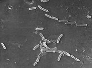 superbacterias causan mas de 1,2 millones de muertes