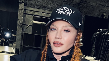 madonna sube una foto de su rostro despues de su cirugia