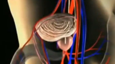 ¿cual es la prueba mas fiable para detectar el cancer de prostata?