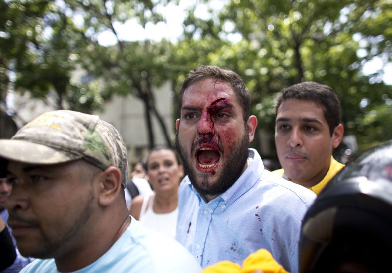 AMS-GEN_VENEZUELA-CRISIS_POLITICA-0.jpg