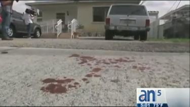americateve | En medio de disputa familiar un padre balea a su hijo.